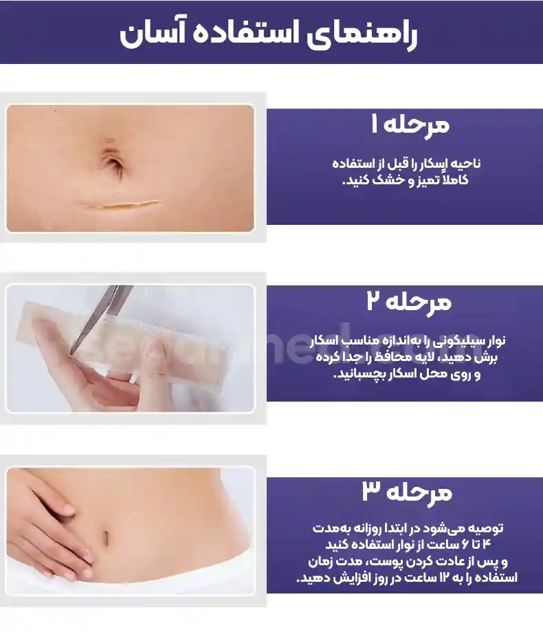 راهنمای استفاده از چسب سیلیکون شیت زخم