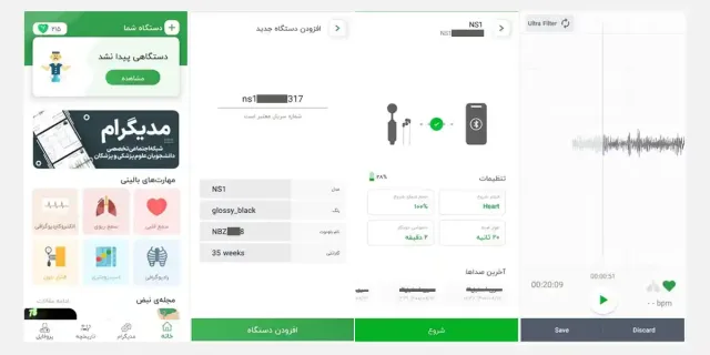 گوشی پزشکی دیجیتال فراهوشمند NS1-SE-Plus نبض آوا (nabzava)