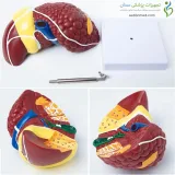مولاژ بیماری های کبد