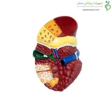 مولاژ بیماری های کبد
