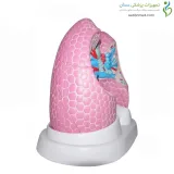 مولاژ سرطان ریه