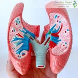 مولاژ سرطان ریه