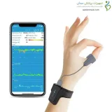 پالس اکسیمتر دیجیتال مچی مدل Checkme O2 ویاتوم (Viatom)