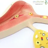 مولاژ فرایند آزادسازی تخمدان کد ۱۵۸۴