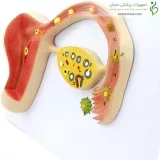 مولاژ فرایند آزادسازی تخمدان کد ۱۵۸۴