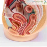 مولاژ ساژینال عضلات لگن زنانه و مردانه