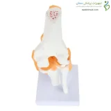 مولاژ مفصل زانو قابل انعطاف