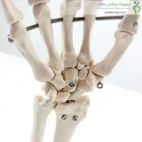 اسکلت مچ دست