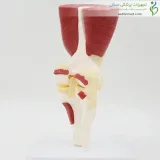 مولاژ مفصل زانو با عضلات