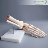 اسکلت مچ پا