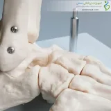 اسکلت مچ پا