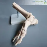 اسکلت مچ پا