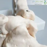 اسکلت مچ پا