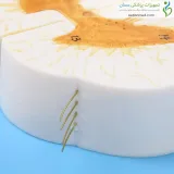 مولاژ نخاع با رشته های عصبی