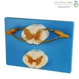 مولاژ نخاع با رشته های عصبی