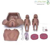 مانکن زایمان طبیعی با دو جنین و جفت
