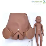 مانکن زایمان طبیعی با دو جنین و جفت