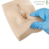 مولاژ اپیزیوتومی (۳ عددی)