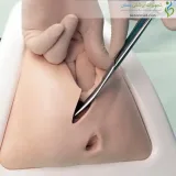 مولاژ اپیزیوتومی پیشرفته