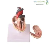 مولاژ قلب کودک