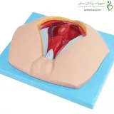 مولاژ ناحیه پرینه مرد
