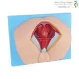 مولاژ ناحیه پرینه مرد