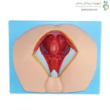 مولاژ ناحیه پرینه مرد