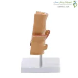 مولاژ رکتوم