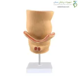 مولاژ رکتوم