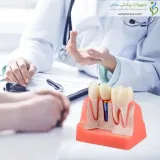 مولاژ ایمپلنت، تاج و بریج دندان