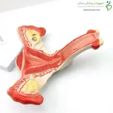 مولاژ رحم و تخمدان