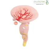 مولاژ ساقه مغز
