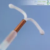 ای‌ یو‌ دی طلا یوروگاین اسپانیا (Eurogine Gold T IUD)