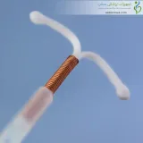 ای‌ یو‌ دی مسی یوروگاین اسپانیا (Eurogine IUD Cu)