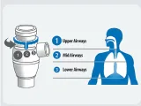 نبولایزر کمپرسوری (OMRON) با قابلیت تعیین اندازه ذرات A-3