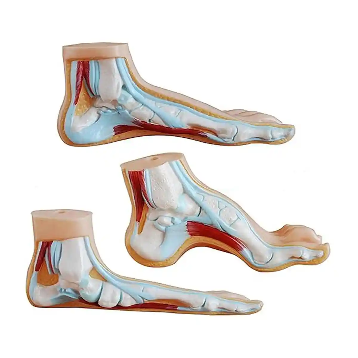 مولاژ قوسهای مختلف کف پا