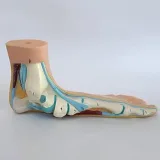 مولاژ قوسهای مختلف کف پا