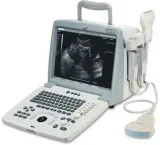دستگاه سونوگرافی پرتابل Full Digital مدل Emp 820 Plus
