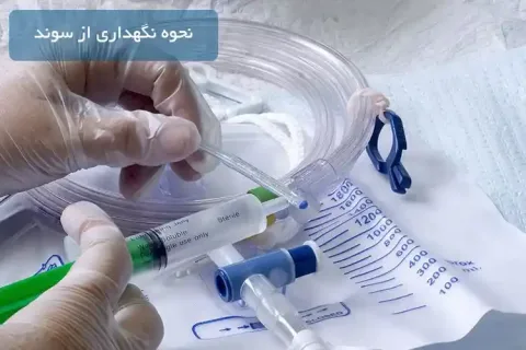 نحوه نگهداری از سوند