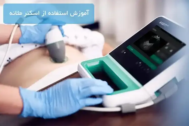 آموزش استفاده از اسکنر مثانه