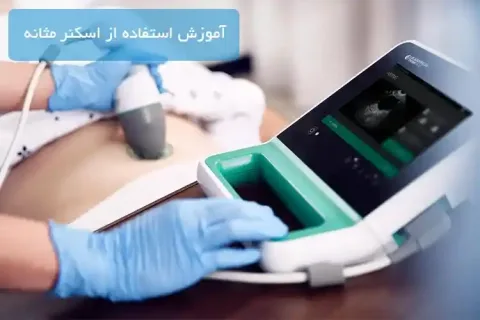 آموزش استفاده از اسکنر مثانه