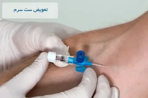 تعویض ست سرم