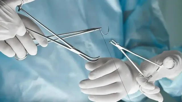 اصول اولیه درباره نخ بخیه