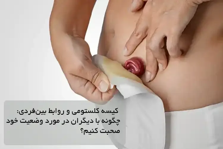 کیسه کلستومی و روابط بین‌فردی: چگونه با دیگران در مورد وضعیت خود صحبت کنیم؟