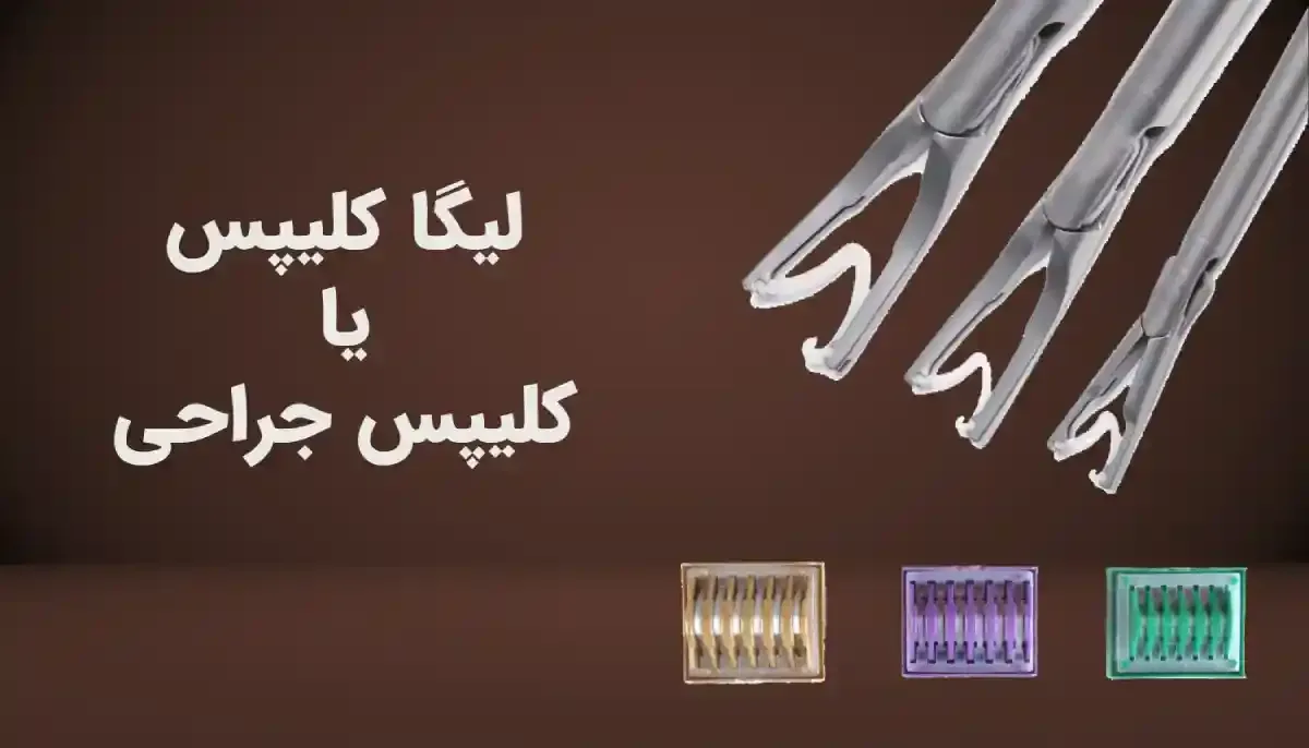لیگا کلیپس در جراحی عمومی چه کاربردی دارد؟