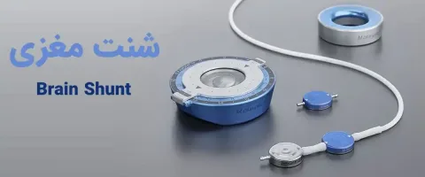 شنت مغزی چیست و برای چه بیمارانی استفاده می شود؟