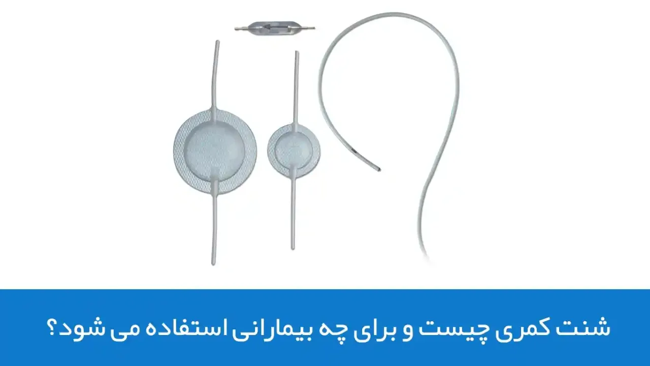 شنت کمری چیست و برای چه بیمارانی استفاده می شود؟