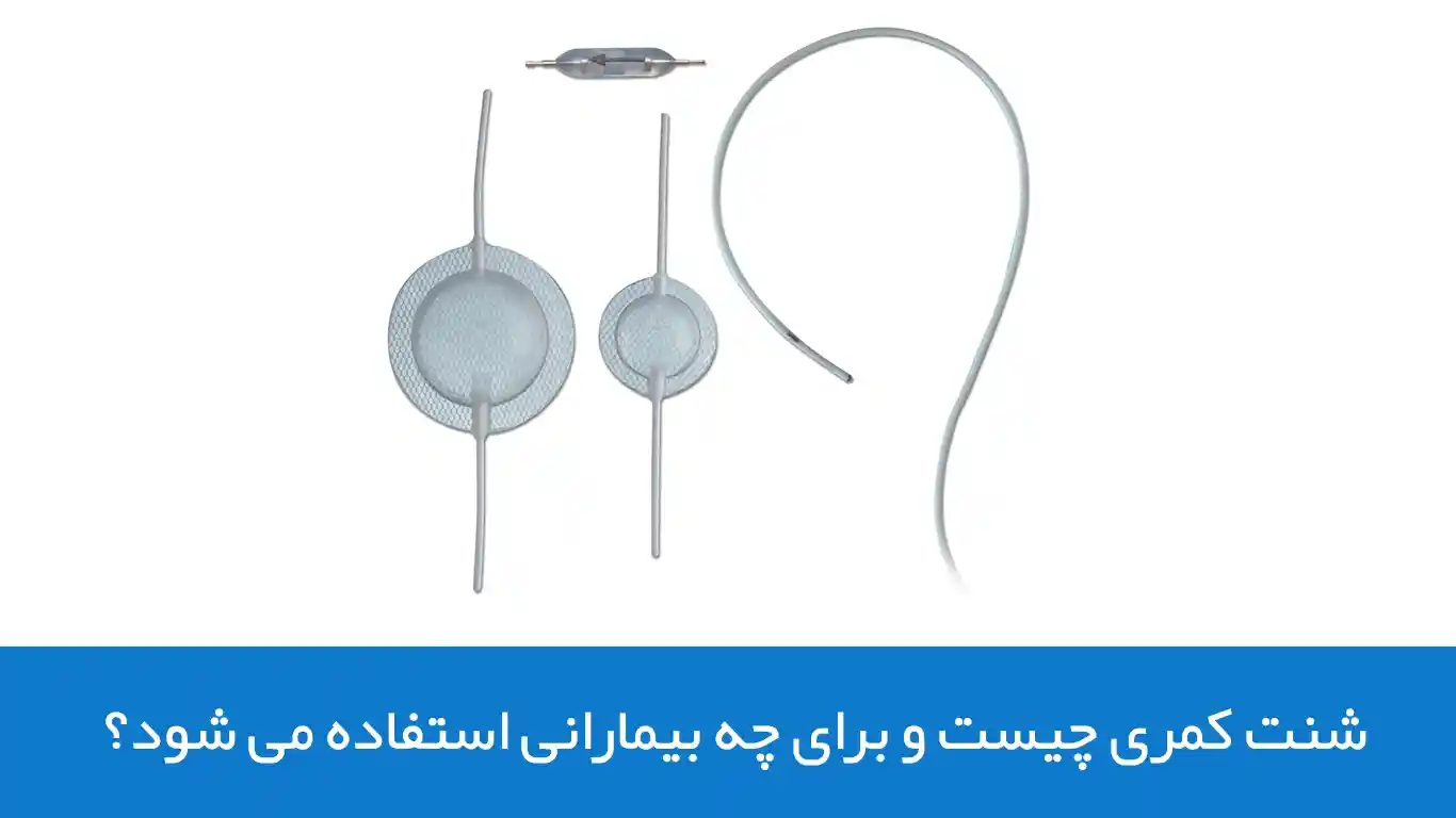 شنت کمری چیست و برای چه بیمارانی استفاده می شود؟
