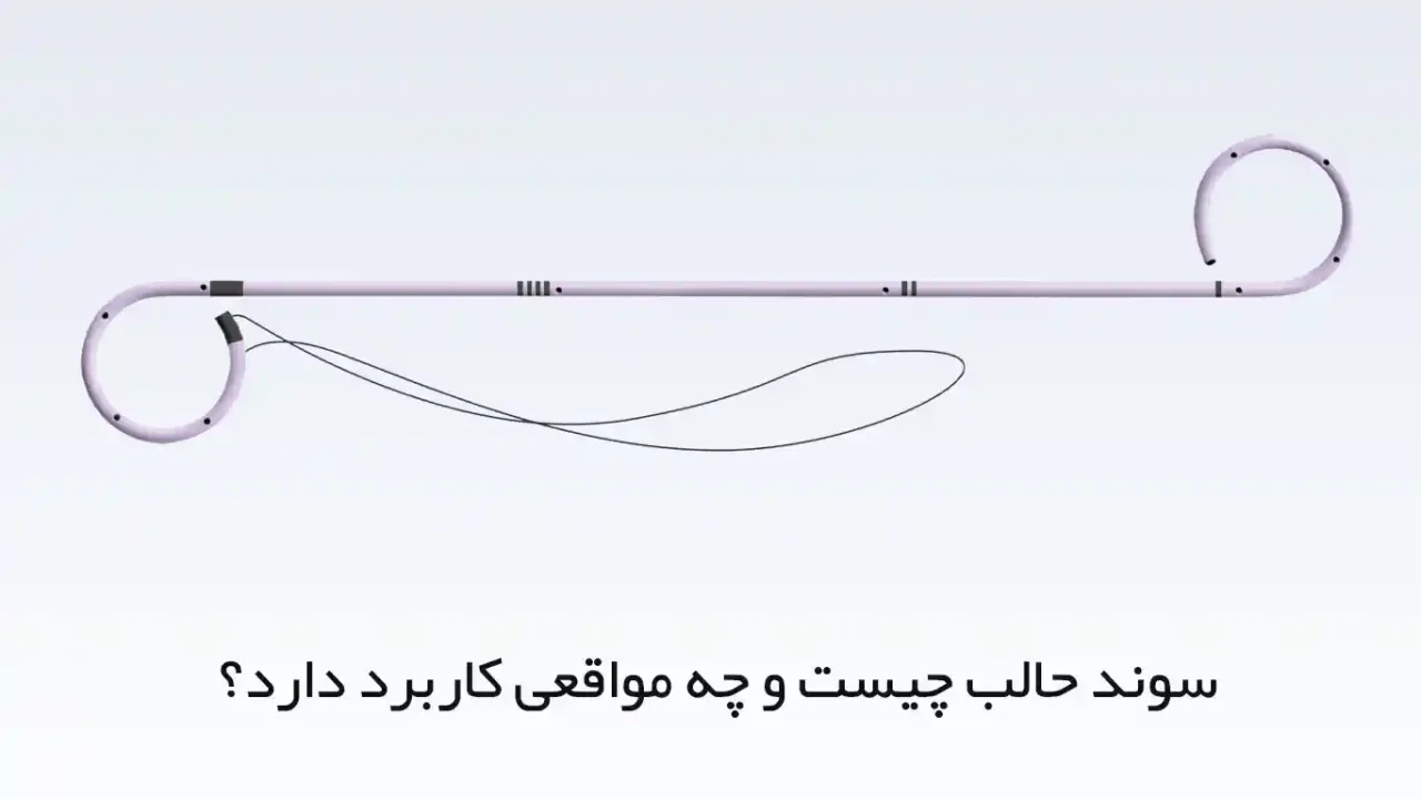 سوند حالب چیست و چه مواقعی کاربرد دارد؟