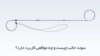 سوند حالب چیست و چه مواقعی کاربرد دارد؟